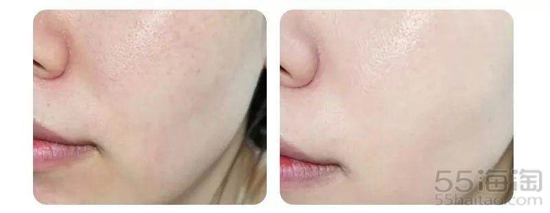 「5姐种草」平价“猛药”THEORDINARY有哪些口碑产品值得入手