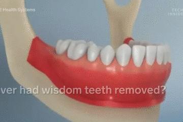 医生手术后最想做什么,医生做完手术以后会怎样