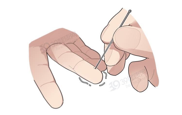 杨永信电击治疗网瘾少年原版视频,杨永信专治网瘾少年