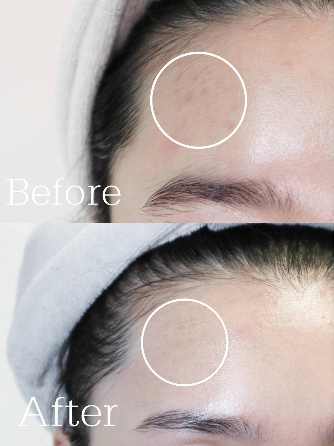 一直在美白却越来越黑的原因,为什么用了美白精华反而黑了