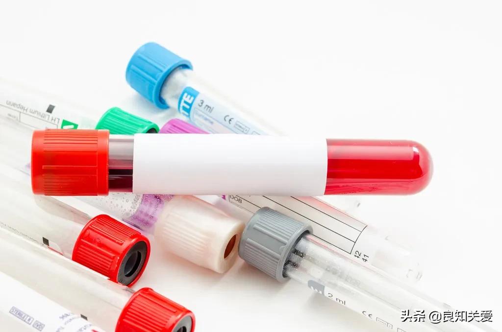 血脂1项查什么指标,血脂一号化验单怎么解读