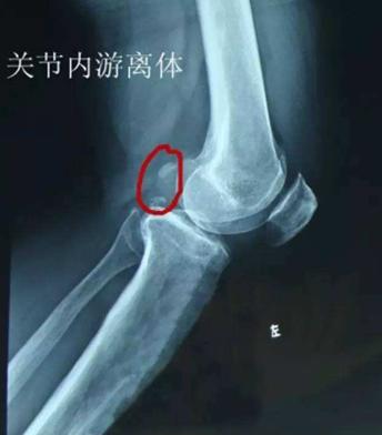 软骨病站立不起来怎么回事,小狗狗髋关节有问题不会站立