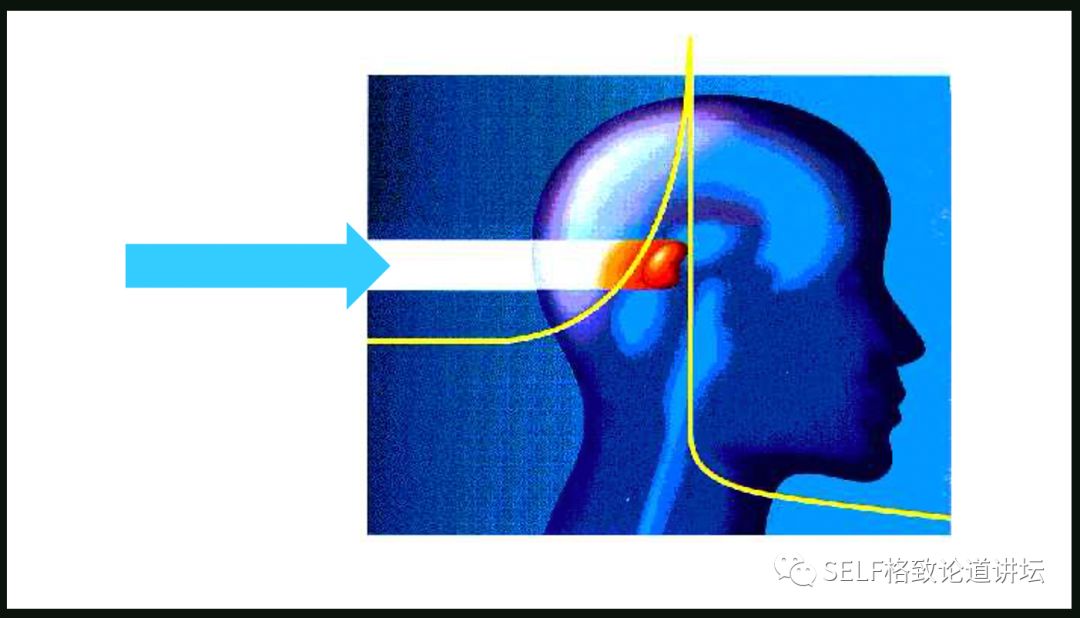 这个装置成功辅助我国两弹爆炸，现在它能治疗肿瘤