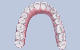 湖北种植牙齿多少钱一个,最新武汉种植牙齿多少钱一颗