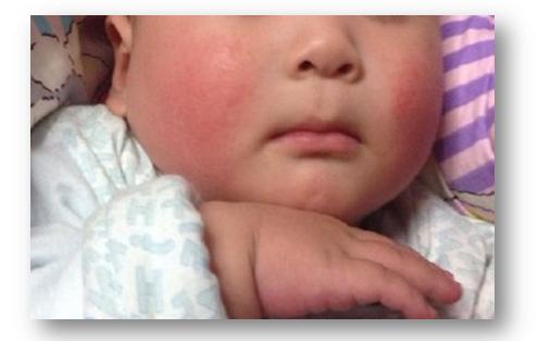 宝宝皴脸擦润肤霜还是保湿霜,润本防皴面霜补水保湿新生儿可用