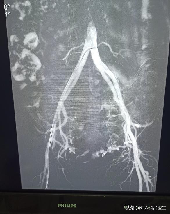 卵巢与子宫调养,女性卵巢和子宫