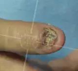 美甲怎么对指甲伤害小,长期美甲怎么保护指甲