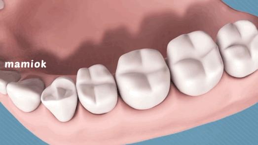 每个饱受“蛀牙”折磨的妈妈都走上了这条路……