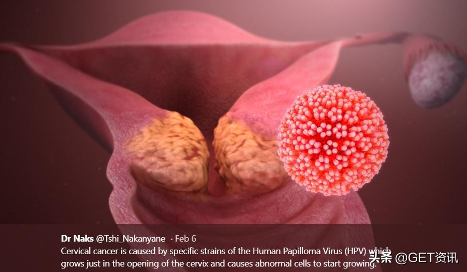 为什么要打hpv疫苗的图片,为什么要打9价hpv疫苗