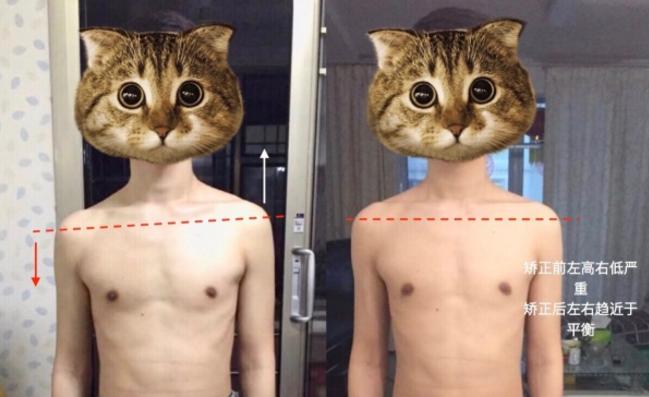 丑怎么快速改善,丑了颜值怎么恢复