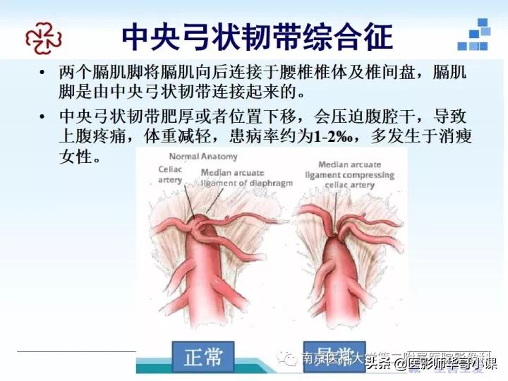 「精品课件」胸部膈肌的解剖及常见病变影像的表现