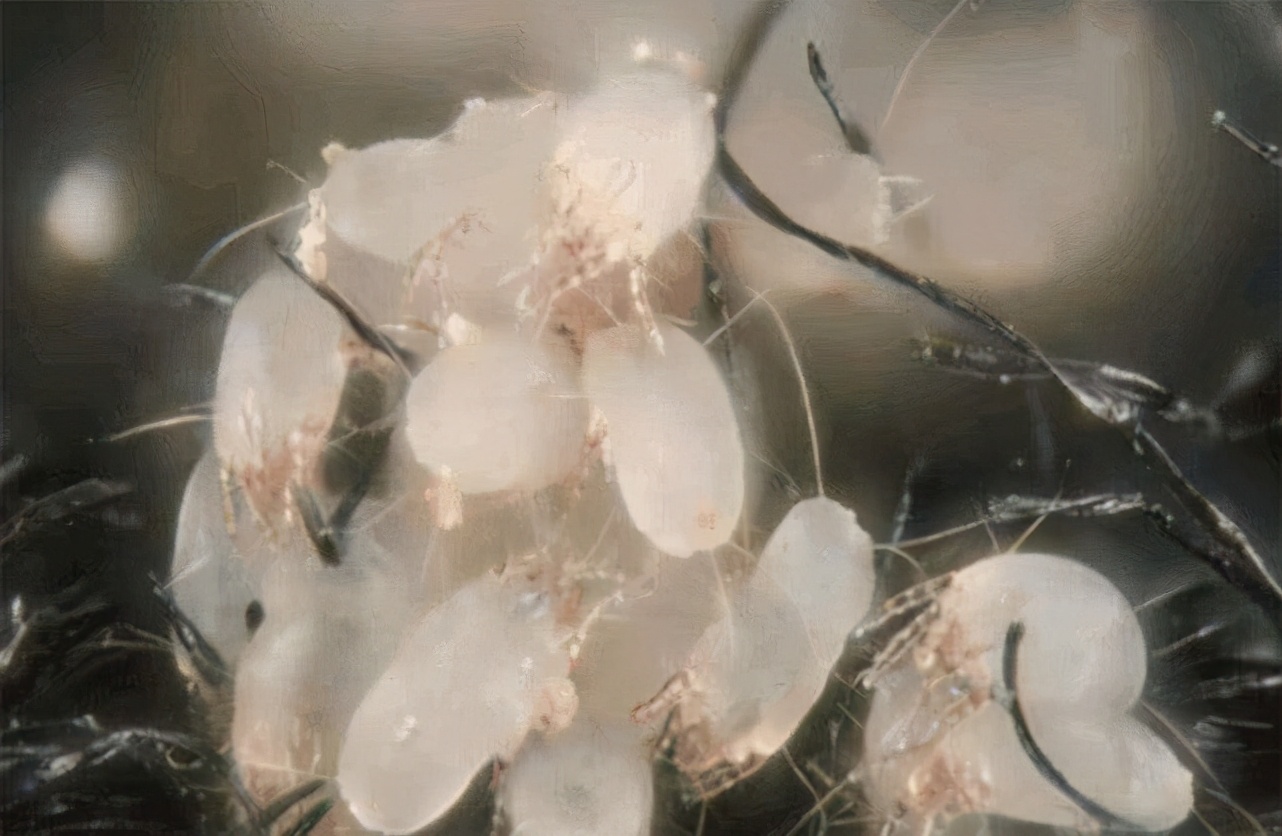 在鼻子上挤出的白色物质是什么,鼻子上的小疙瘩挤出来的白色东西