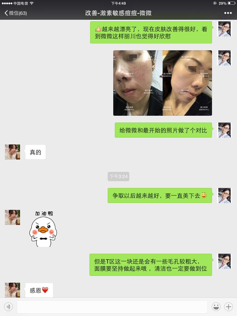 兰亭护肤品能治疗激素脸吗,兰亭护肤品有适合油皮长痘用的吗