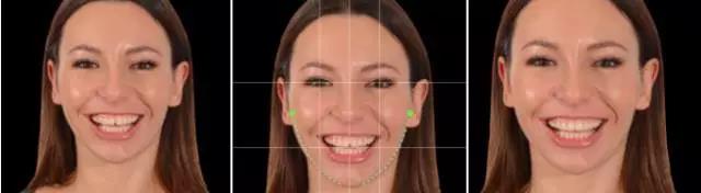 国家有关于牙齿的补贴吗,牙齿补贴报销政策