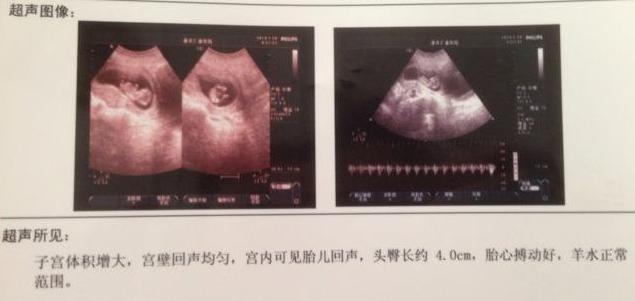 肝胆胰脾肾彩超报告单专用术语,一张图看懂b超检查单