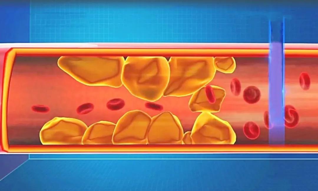 双下巴可不仅仅是胖，还有可能是疾病的信号！尤其是脖子粗过这个数的人，更危险
