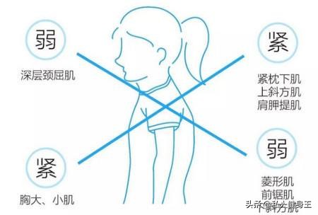 如何解决圆肩,瑜伽改善圆肩驼背的60分课程编排