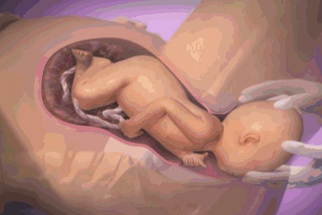 顺产究竟有多疼看完你就清楚了,如何减轻顺产生孩子疼痛