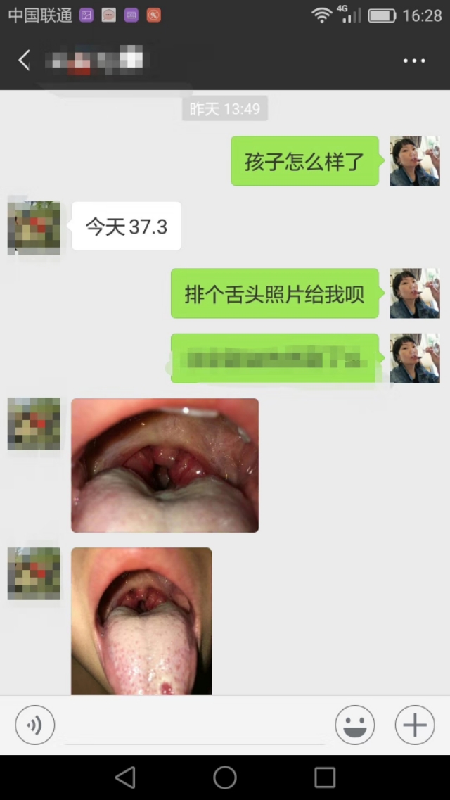 中医临床治疗扁桃体发炎医案,化脓性扁桃体炎中医辨证论治