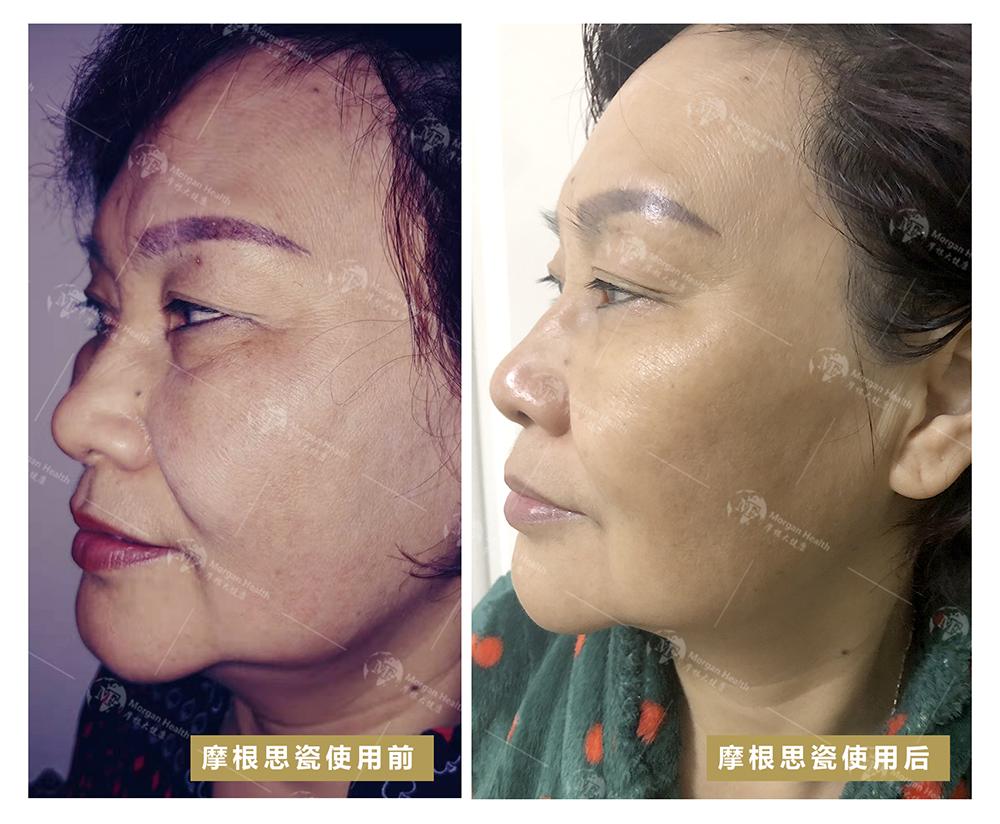 自然疗愈与觉醒,自然疗愈塑造健康理念