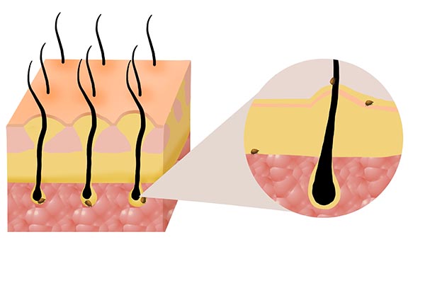 剪发虫会带来什么危害,为什么会出现剪发虫