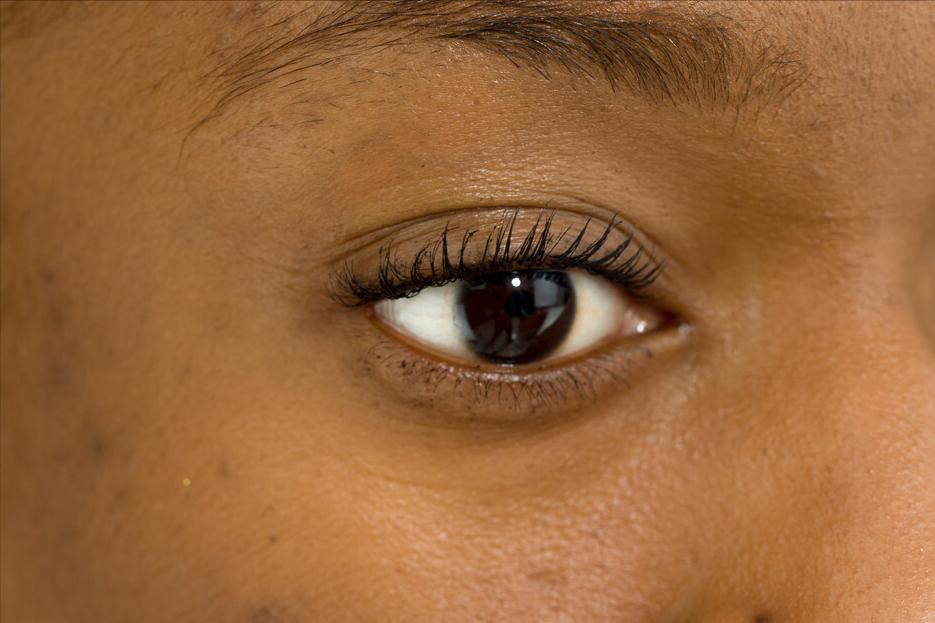 湿热该吃什么补脾胃,脾胃湿热怎么食物调理恢复最快