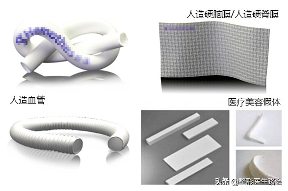 膨体隆鼻很假吗,膨体隆鼻假不假