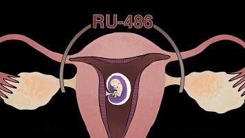 那些避孕失败的女孩,后来怎样了?