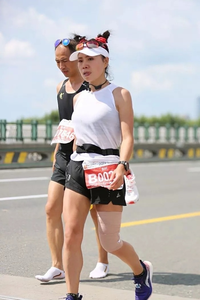 髌骨带和自粘绷带作用一样,韧带松弛髌骨带和护膝哪个效果好