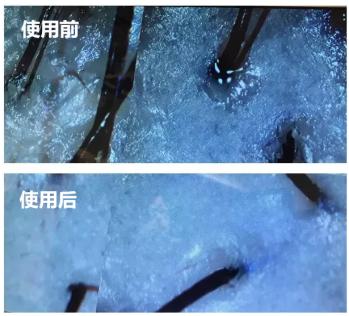 澳洲茶树精油洗发水去头屑,头发一摸全是油