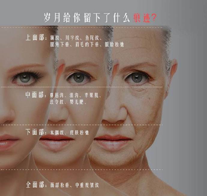 42岁做拉皮还是线雕,做线雕一年后可以做拉皮术吗