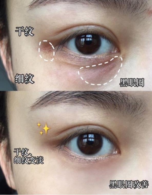 小棕瓶眼霜如何用得更彻底,小棕眼瓶眼霜