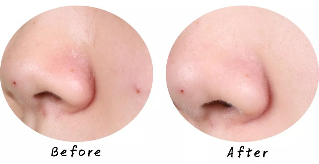 十大清洁面膜排行榜混合性皮肤,十大好用清洁面膜