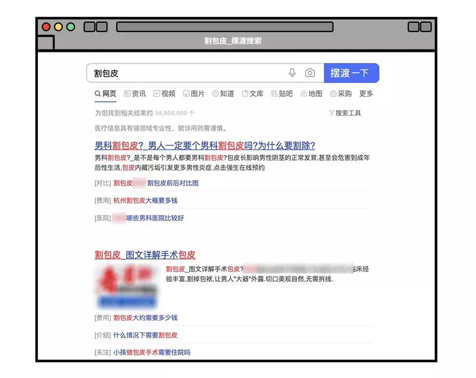 割包皮能当天做当天走吗,割包皮当天去医院当天就能割吗