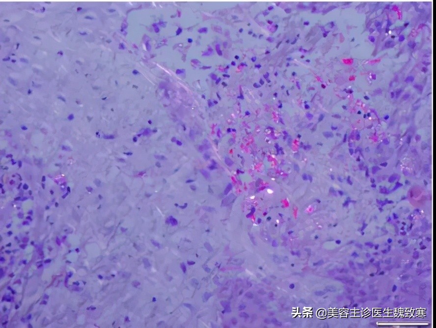 韩式纹眉有哪些种类,韩式纹眉痛吗