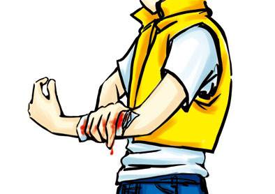 脸部受伤需要打破伤风针吗,受伤就要打破伤风吗