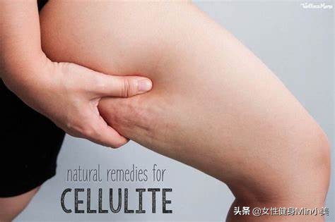 大腿后侧橘皮组织明显怎么办,怎样去掉臀部和大腿后部的橘皮