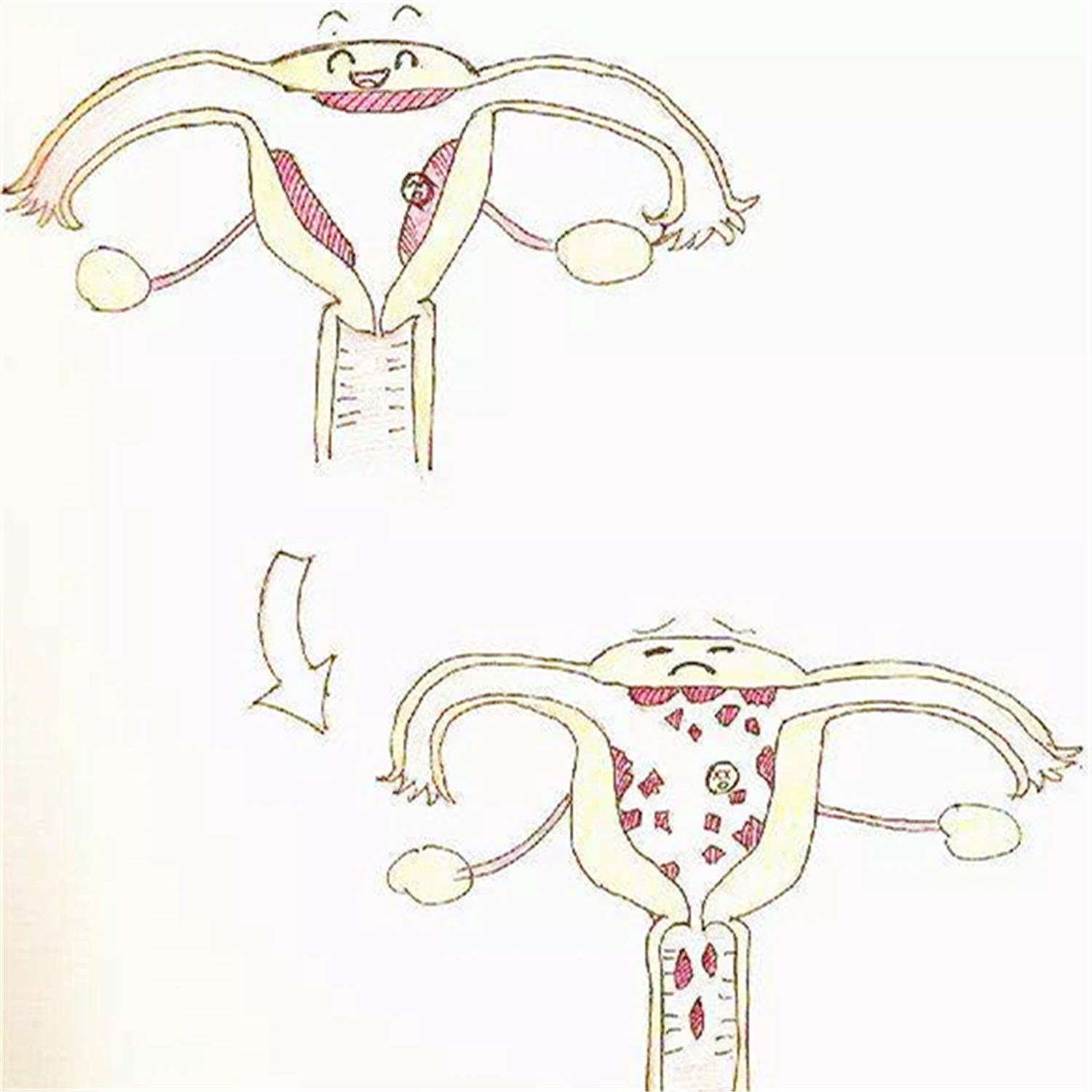 流产后为什么验孕棒还是两条杠,验孕棒能验出是来月经还是流产吗
