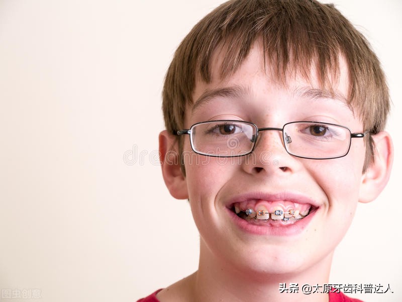 有龅牙怎么办,娃娃龅牙咋办