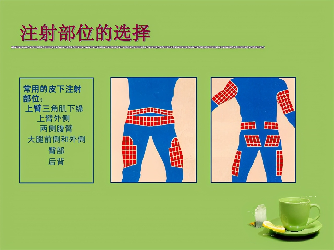 降糖药超长效,降糖药降体重