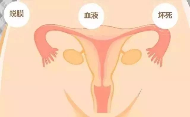 产后妈妈如何看自己月经恢复,产后怎么判断子宫恢复位置正常