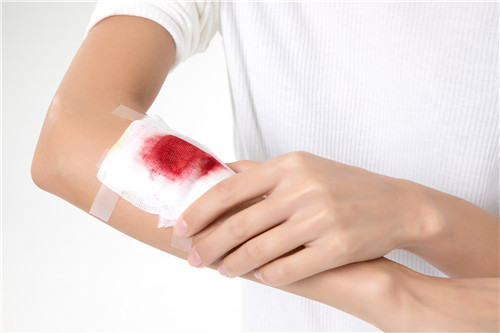 磕碰后淤青会消除吗,不小心磕碰到淤青图