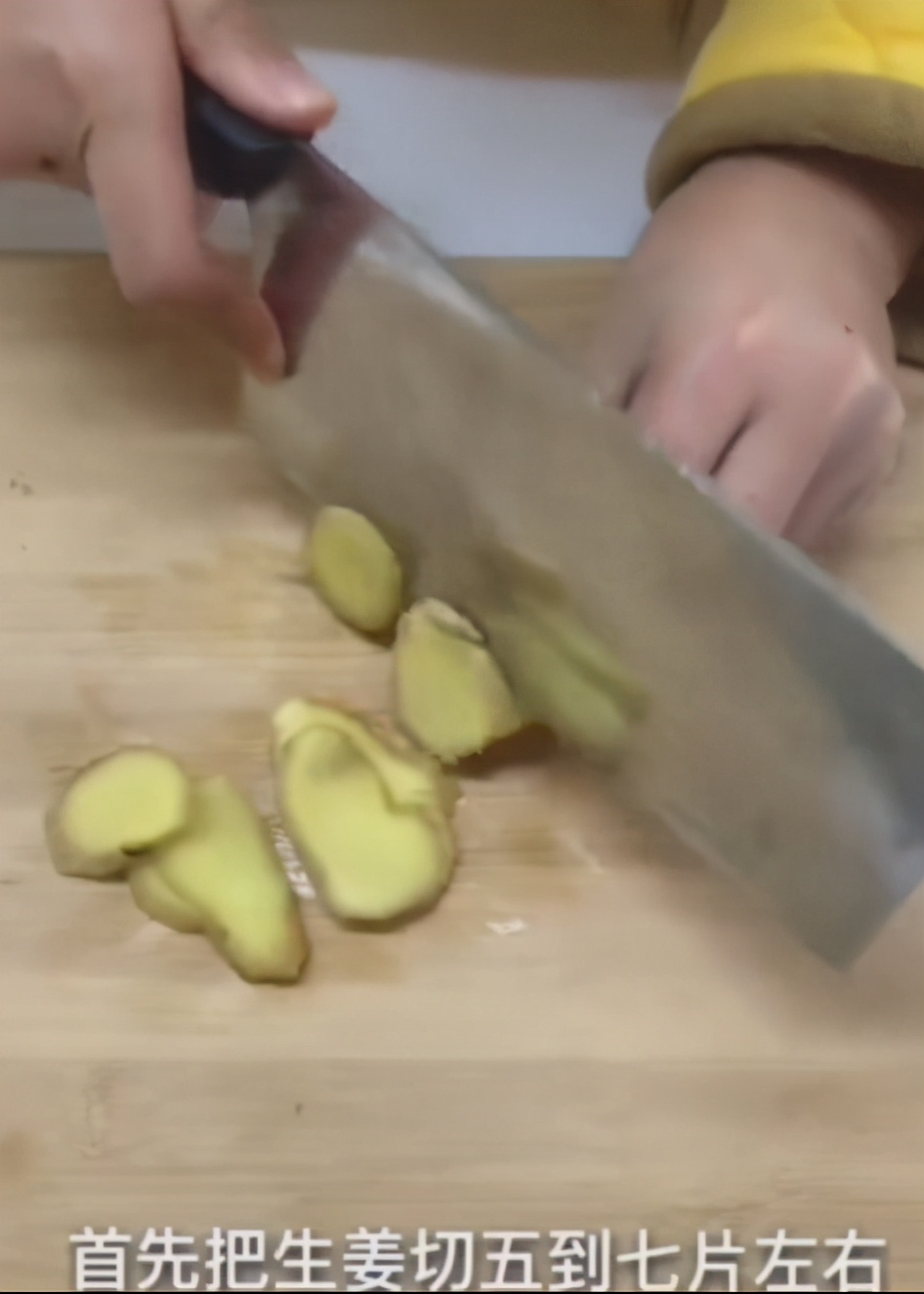 男性脱发怎么办最有效的方法,油脂性脱发治疗最有效的方法