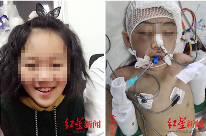 恶毒继母被判无期,用法治“钉死”虐待儿童行为