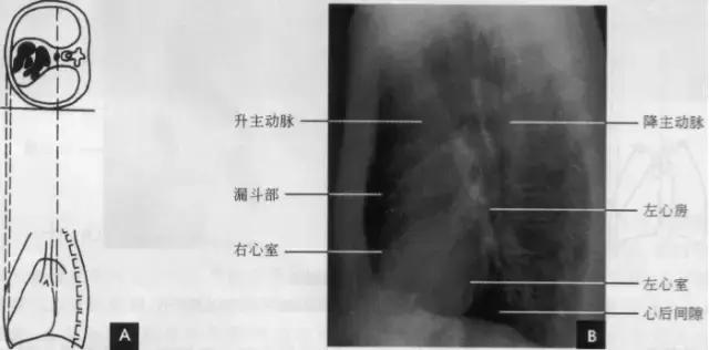 休闲小白鞋夏,献血小板相当于献血多少