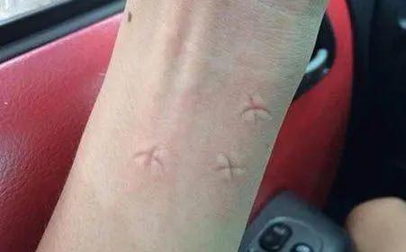 用什么方法灭蚊子最管用,灭蚊子的土方法