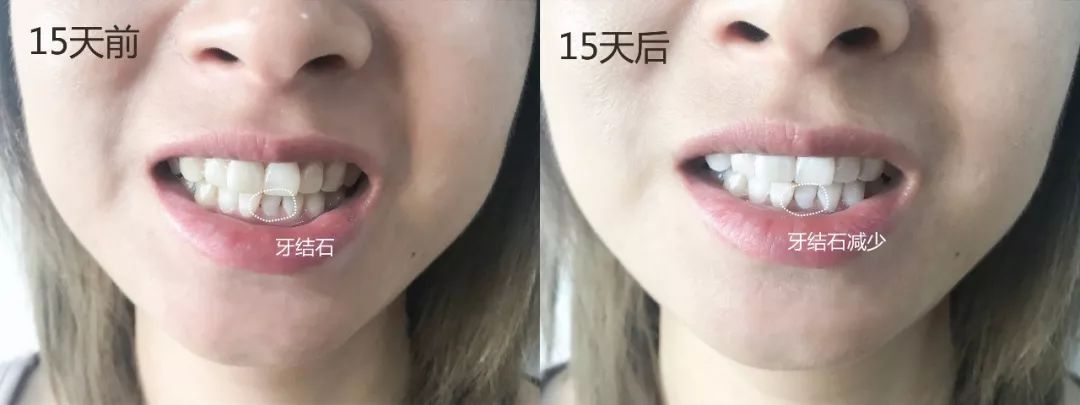 李佳琦嚼的牙膏,李佳琦亲享口香糖牙膏