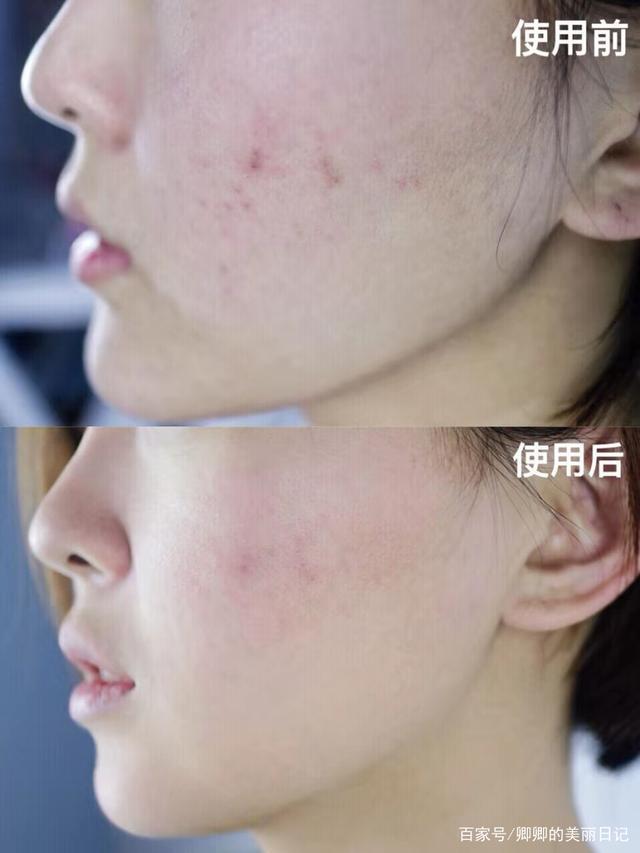 市面上那么多美容仪是智商税吗,全方位美容仪是不是智商税