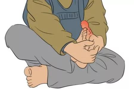 激素治痛风急性发作期的效果真好,激素治疗痛风伤肾