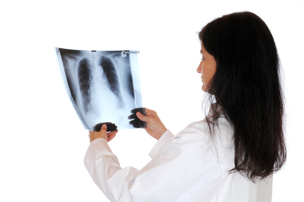 腰椎间盘膨出怎么治效果最好,腰椎间盘膨出有什么好的治疗方法